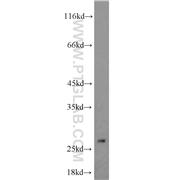 EIF4H Rabbit Polyclonal Antibody (11012-1-AP)