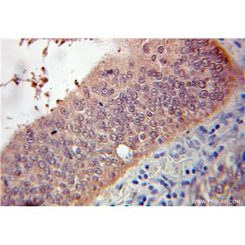 PPP1R1B Rabbit Polyclonal Antibody (10748-1-AP)