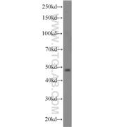 PACSIN3 Rabbit Polyclonal Antibody (10639-1-AP)