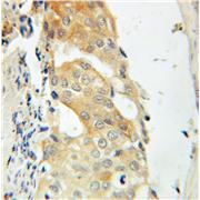 CNKSR1 Rabbit Polyclonal Antibody (10885-1-AP)