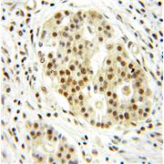 DRAP1 Rabbit Polyclonal Antibody (11020-1-AP)