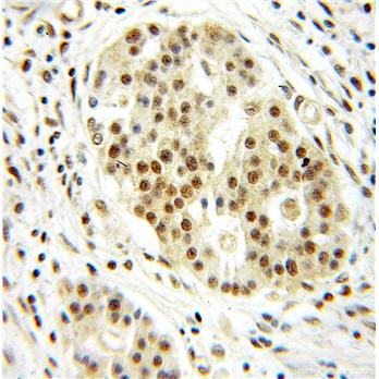 DRAP1 Rabbit Polyclonal Antibody (11020-1-AP)
