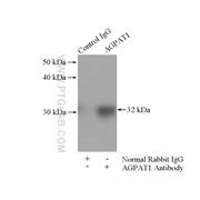 AGPAT1 Rabbit Polyclonal Antibody (10601-1-AP)