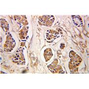 PMM2 Rabbit Polyclonal Antibody (10666-1-AP)