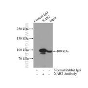 XAB2 Rabbit Polyclonal Antibody (10637-1-AP)