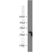 STX10 Rabbit Polyclonal Antibody (11036-1-AP)