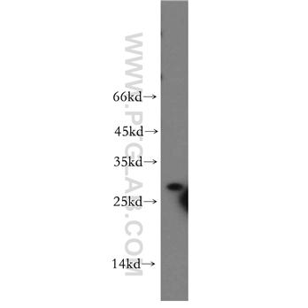 STX10 Rabbit Polyclonal Antibody (11036-1-AP)