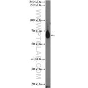 IL13RA2 Rabbit Polyclonal Antibody (11059-1-AP)