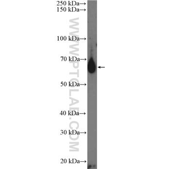 IL13RA2 Rabbit Polyclonal Antibody (11059-1-AP)