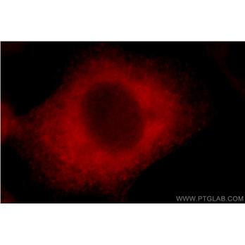 BAG3 Rabbit Polyclonal Antibody (10599-1-AP)