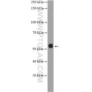 PKNOX1 Rabbit Polyclonal Antibody (10614-1-AP)
