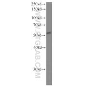 FADS1 Rabbit Polyclonal Antibody (10627-1-AP)