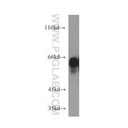 PTPRN Rabbit Polyclonal Antibody (10584-1-AP)