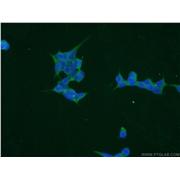 TPMT Rabbit Polyclonal Antibody (10682-1-AP)