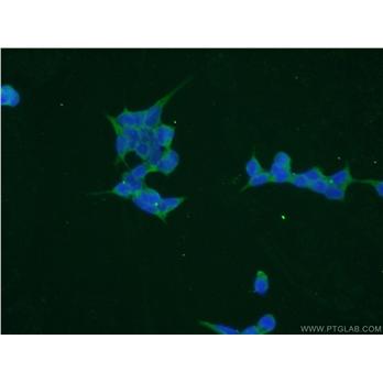 TPMT Rabbit Polyclonal Antibody (10682-1-AP)