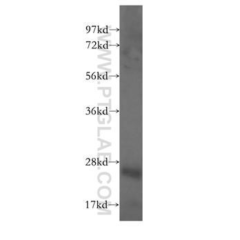 ITGB3BP Rabbit Polyclonal Antibody (10743-1-AP)