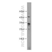 CNOT8 Rabbit Polyclonal Antibody (10752-1-AP)