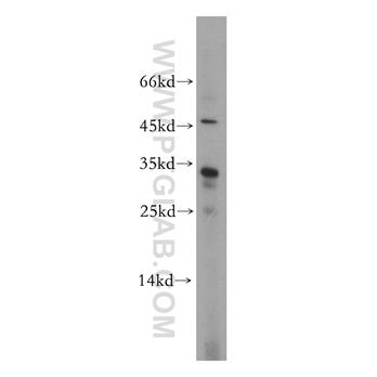 CNOT8 Rabbit Polyclonal Antibody (10752-1-AP)