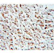 ASF1B Rabbit Polyclonal Antibody (11011-1-AP)