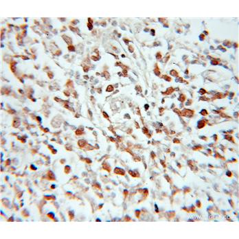 ASF1B Rabbit Polyclonal Antibody (11011-1-AP)