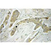 MRPS22 Rabbit Polyclonal Antibody (10984-1-AP)