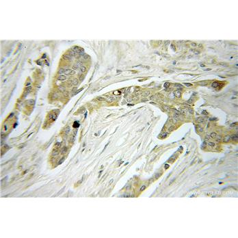 MRPS22 Rabbit Polyclonal Antibody (10984-1-AP)