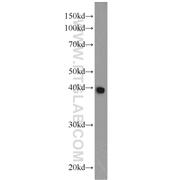 CSNK2A2 Rabbit Polyclonal Antibody (10606-1-AP)