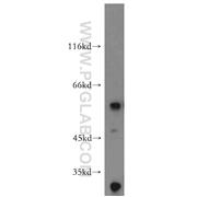 AP1M2 Rabbit Polyclonal Antibody (10618-1-AP)