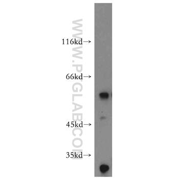 AP1M2 Rabbit Polyclonal Antibody (10618-1-AP)