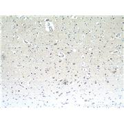 NMB Rabbit Polyclonal Antibody (10888-1-AP)