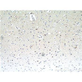 NMB Rabbit Polyclonal Antibody (10888-1-AP)