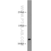 CYLD Rabbit Polyclonal Antibody (11110-1-AP)