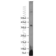 WBP1 Rabbit Polyclonal Antibody (11042-1-AP)
