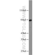 CD58 Rabbit Polyclonal Antibody (10878-1-AP)