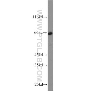 CD58 Rabbit Polyclonal Antibody (10878-1-AP)
