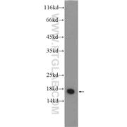 GMFB Rabbit Polyclonal Antibody (10690-1-AP)
