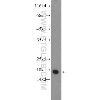 GMFB Rabbit Polyclonal Antibody (10690-1-AP)