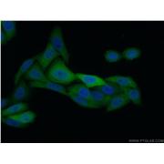 KPNA2 Rabbit Polyclonal Antibody (10819-1-AP)