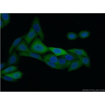 KPNA2 Rabbit Polyclonal Antibody (10819-1-AP)