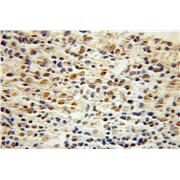 CTCF Rabbit Polyclonal Antibody (10915-1-AP)
