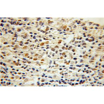 CTCF Rabbit Polyclonal Antibody (10915-1-AP)