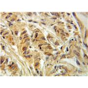 ACOT11 Rabbit Polyclonal Antibody (10776-1-AP)