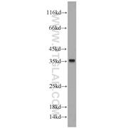 CYB5R3 Rabbit Polyclonal Antibody (10894-1-AP)