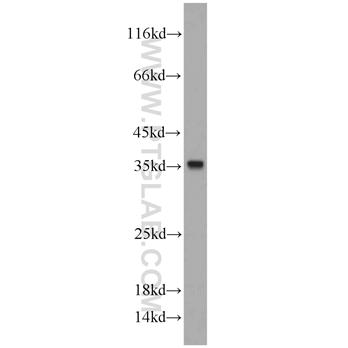 CYB5R3 Rabbit Polyclonal Antibody (10894-1-AP)