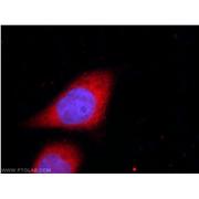 UFD1L Rabbit Polyclonal Antibody (10615-1-AP)