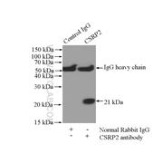 CSRP2 Rabbit Polyclonal Antibody (10892-2-AP)