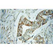 VDAC1 Rabbit Polyclonal Antibody (10866-1-AP)