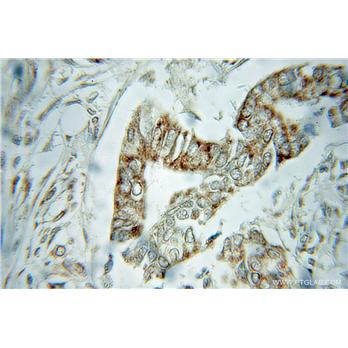 VDAC1 Rabbit Polyclonal Antibody (10866-1-AP)