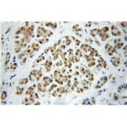 DNAJC7 Rabbit Polyclonal Antibody (11090-1-AP)
