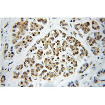 DNAJC7 Rabbit Polyclonal Antibody (11090-1-AP)
